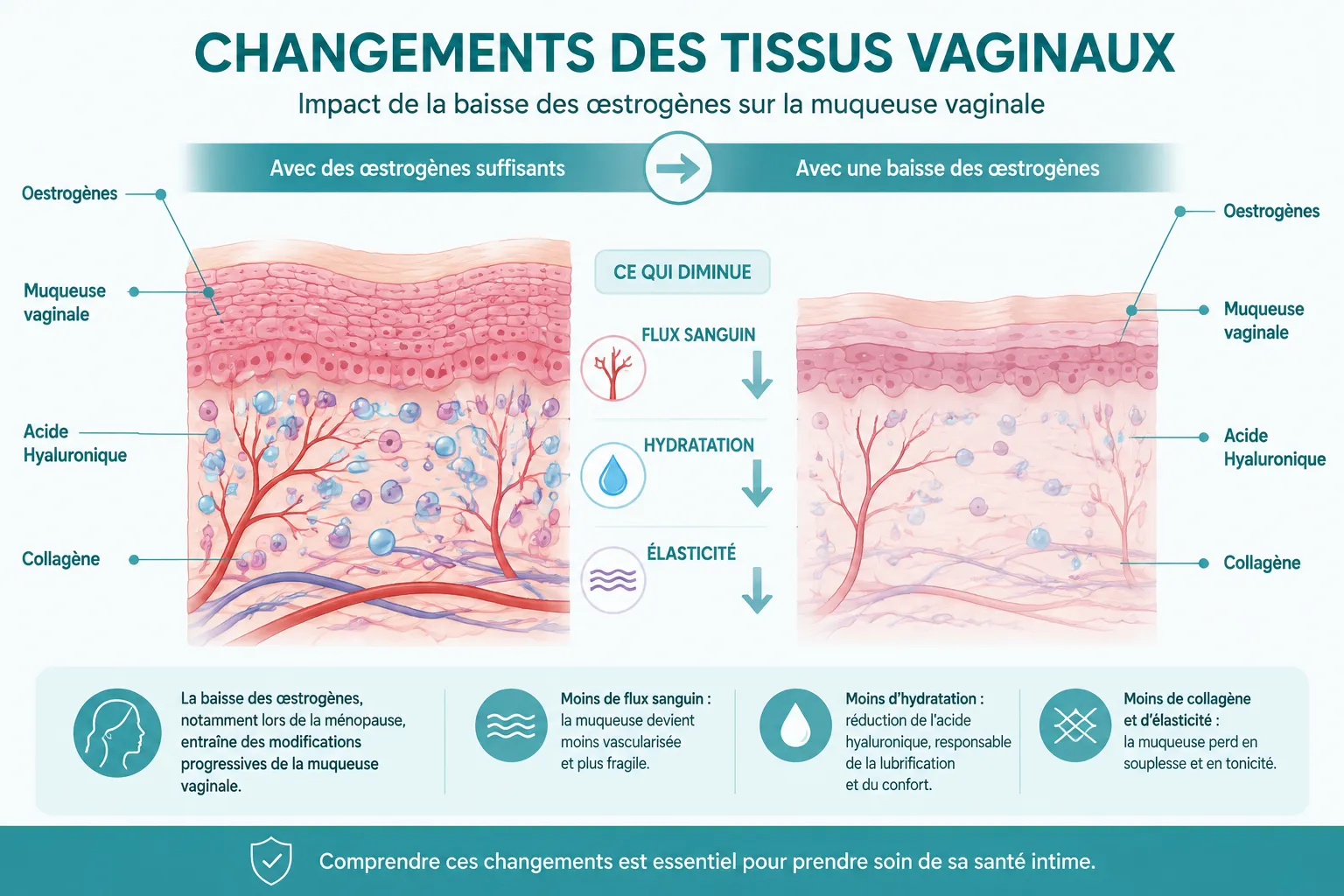 Pourquoi la ménopause cause la sécheresse vaginale ?